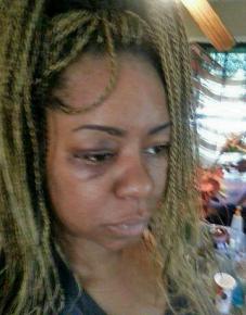 Danielle Adams' injuries were caused by Chicago police